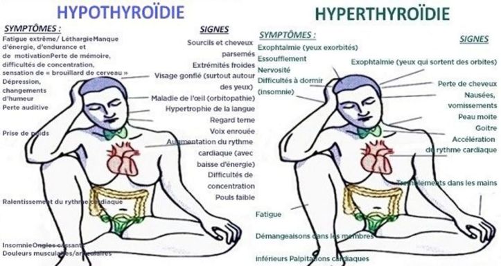 Thyroïde - 3